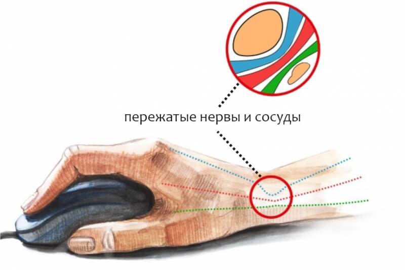 Кракен не работает тор